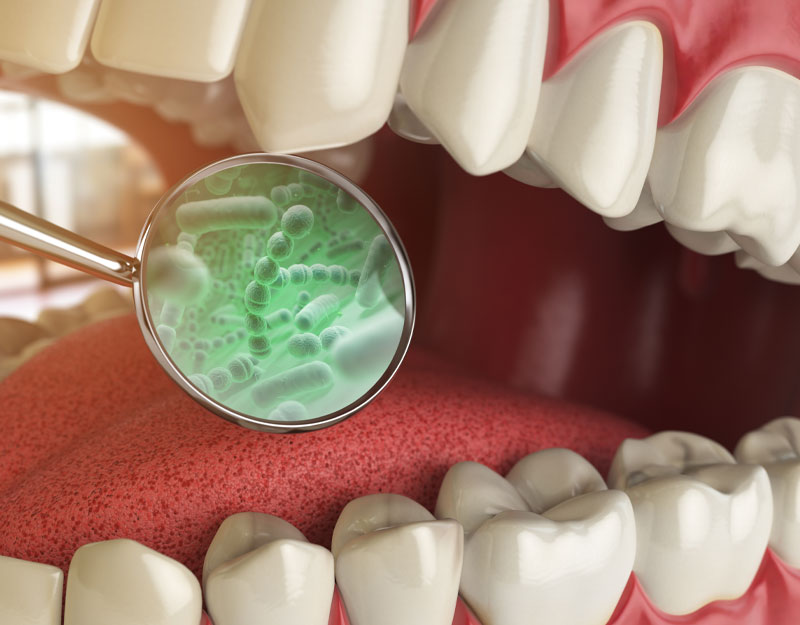 teeth bacteria